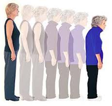 Xerrada: Com prevenir l'osteoporosi.